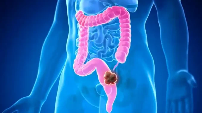 colon-678x381