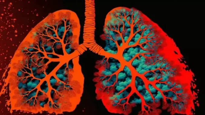 COPD-Management-1024x576-2508040739-678x381