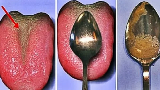 জিহ্বা